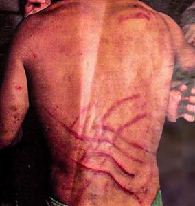 La espalda de un duro: Pablo Garreton