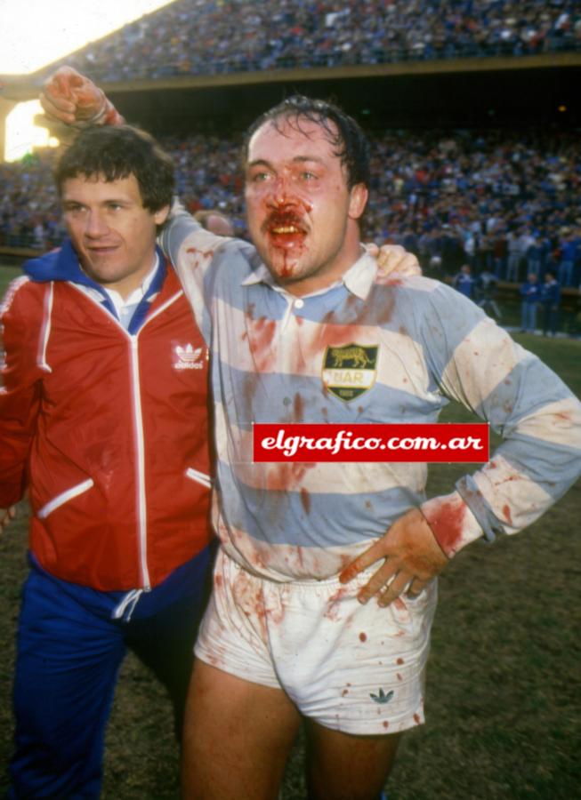 Diego CASH -  Selección Argentina de Rugby XV -  - Rugby - Diego Cash, dando muestra de la batalla, con su nariz rota () Photo by:  | Siuxy Sports 1988-06-25